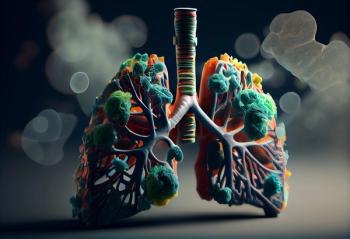 Human Lung model illness, Lung cancer and lung disease. Generative AI - Image credit: Royalty-Free | stock.adobe.com