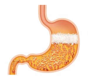 Proton Pump Inhibitors: How to Deprescribe These Nutrient Robbers 