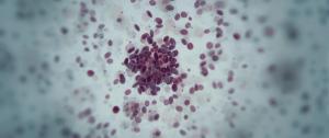 EPCORE DLBCL-1 Trial Demonstrates Durable Responses, PFS Benefit With Epcoritamab in RR LBCL