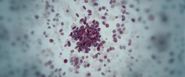 EPCORE DLBCL-1 Trial Demonstrates Durable Responses, PFS Benefit With Epcoritamab in RR LBCL