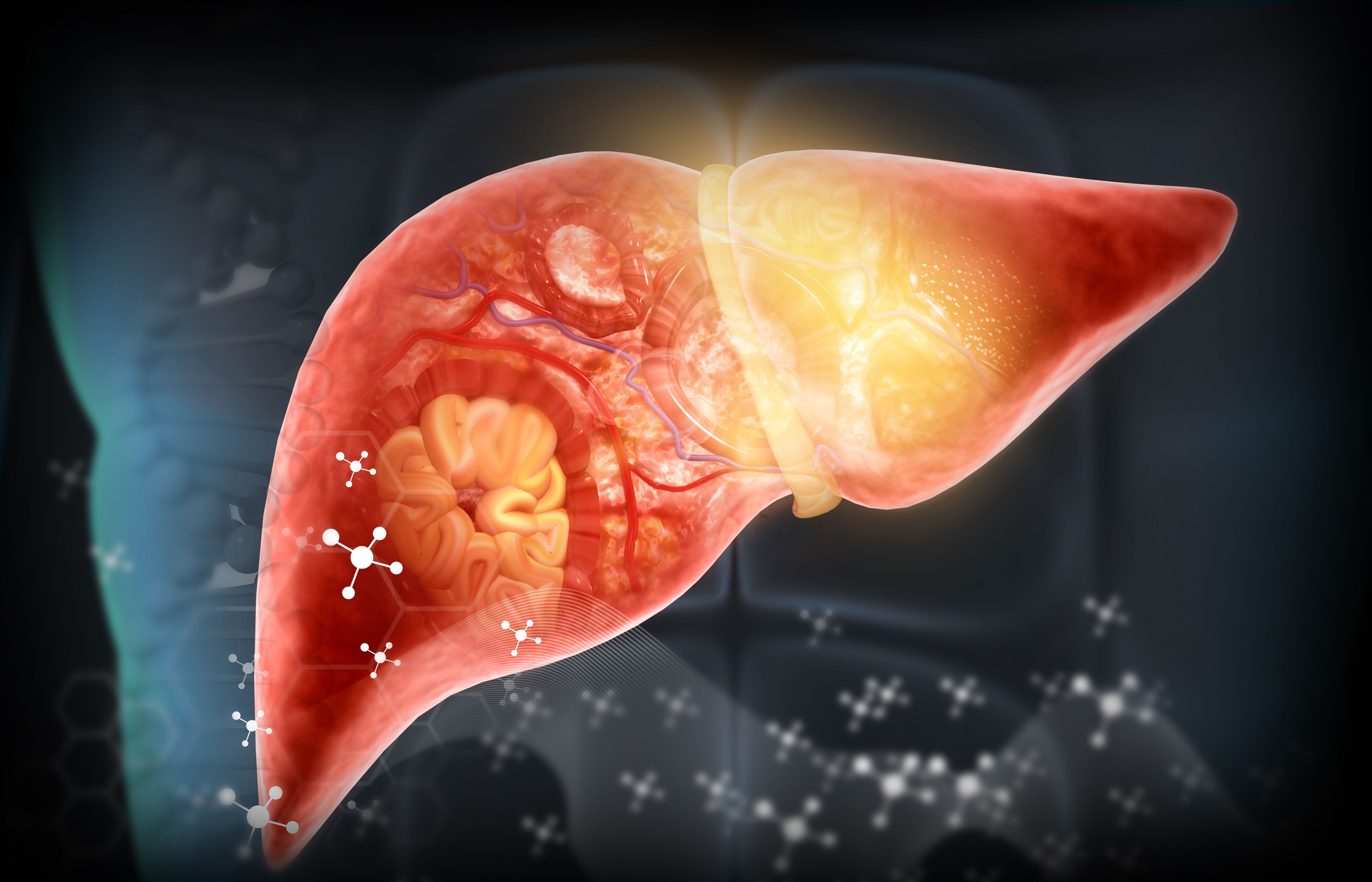 Liver with fibrosis -- Image credit: Rasi | stock.adobe.com