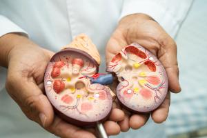 Health care professional holding a model depicting chronic kidney disease (CKD) -- Image credit: amazing studio | stock.adobe.com