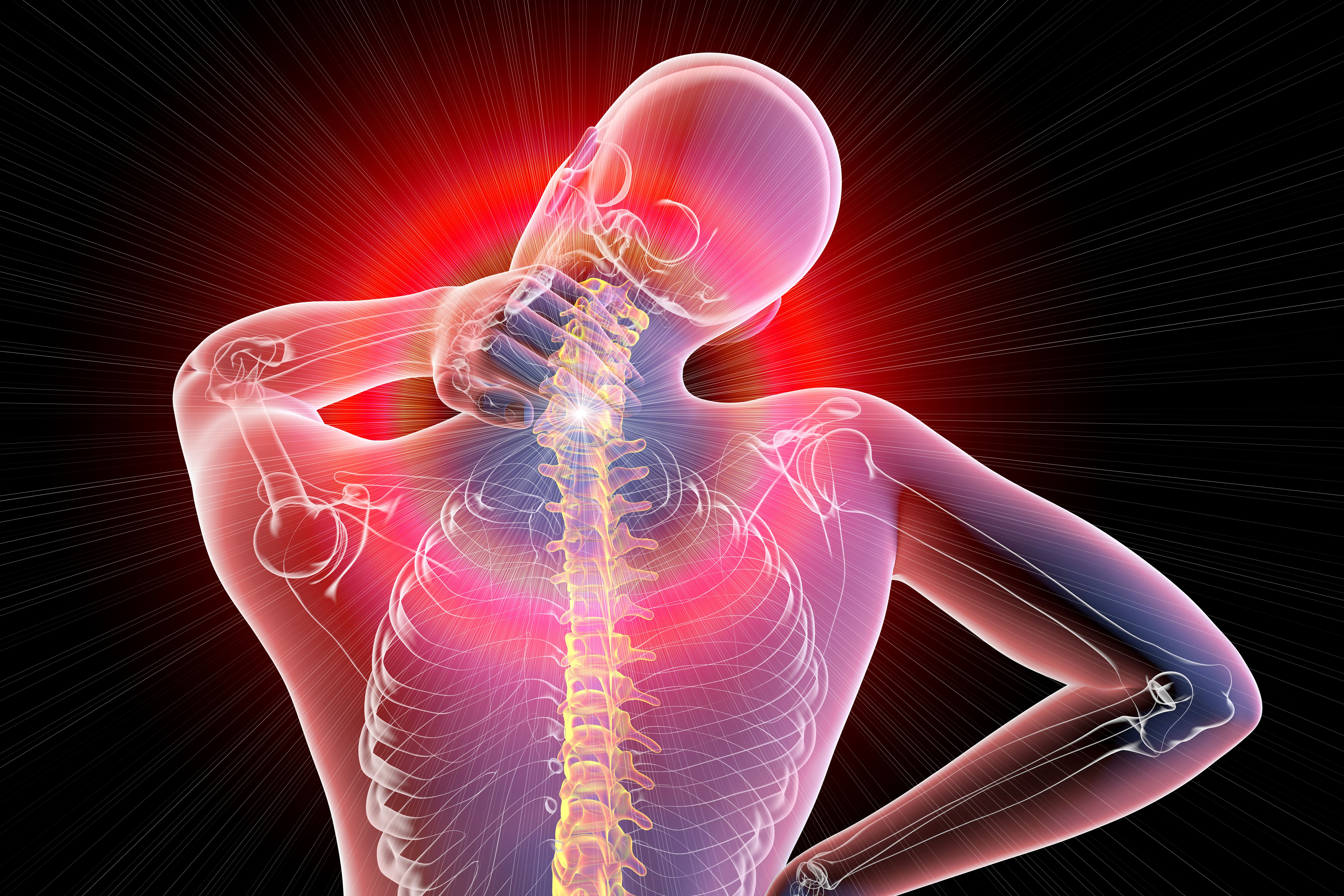 Neck pain, illustration | Image Credit: Dr_Microbe | stock.adobe.com