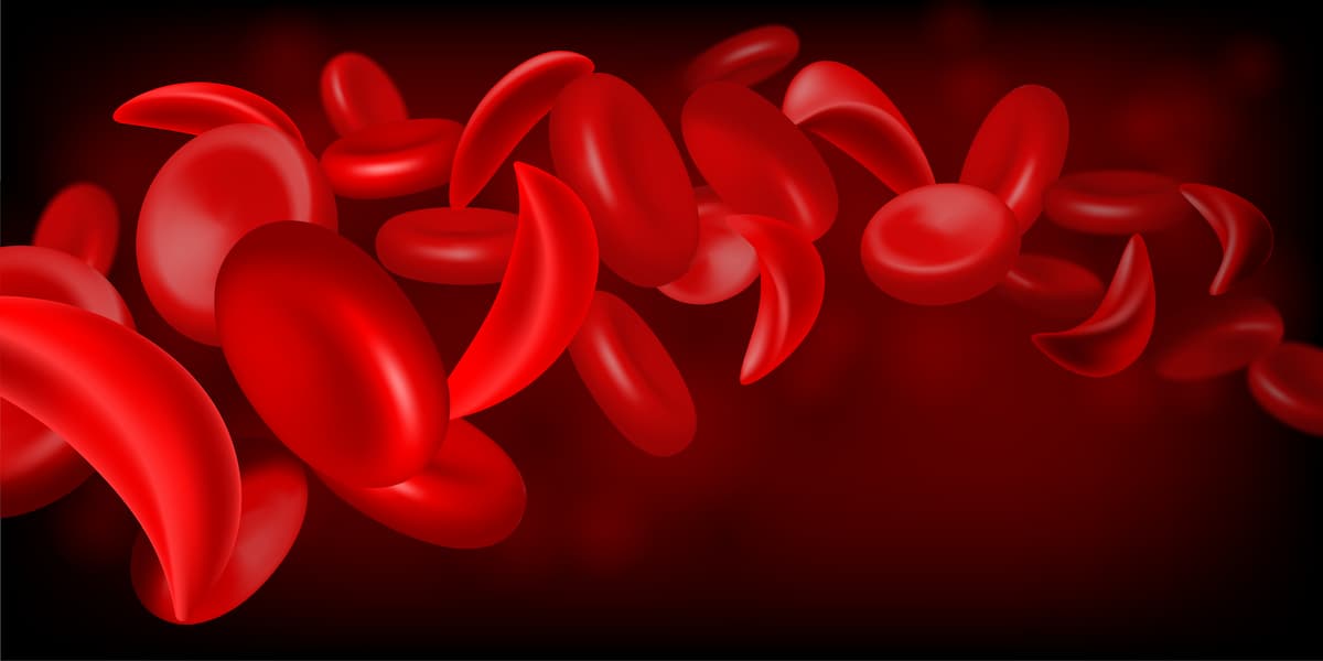Normal red blood cell and sickle cell flow inside in artery.
