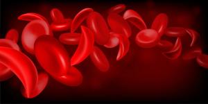 Normal red blood cell and sickle cell flow inside in artery.