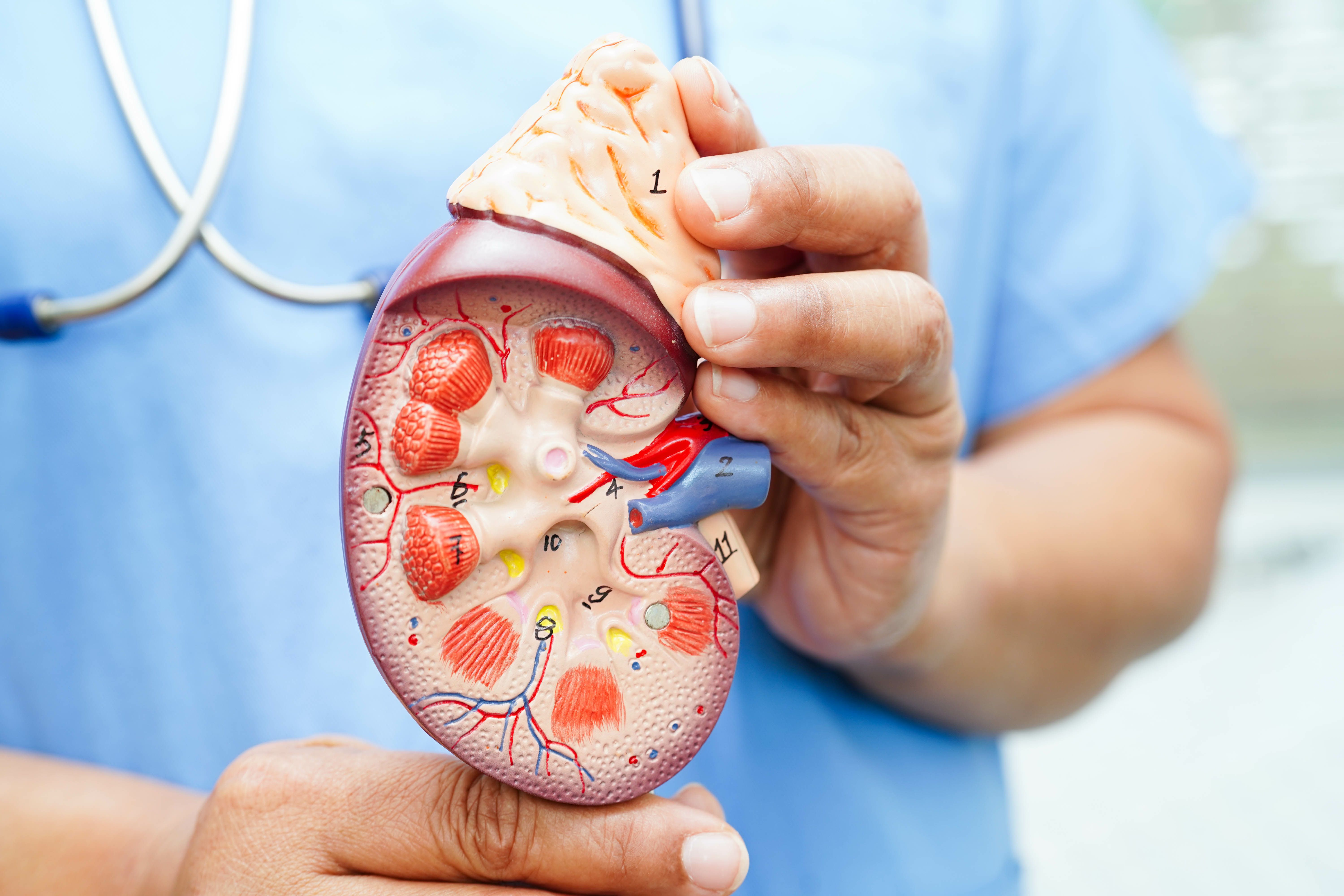 Model of kidney with chronic kidney disease (CKD) -- Image credit: manassanant | stock.adobe.com