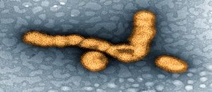Widespread Flu Epidemic Breaking Records