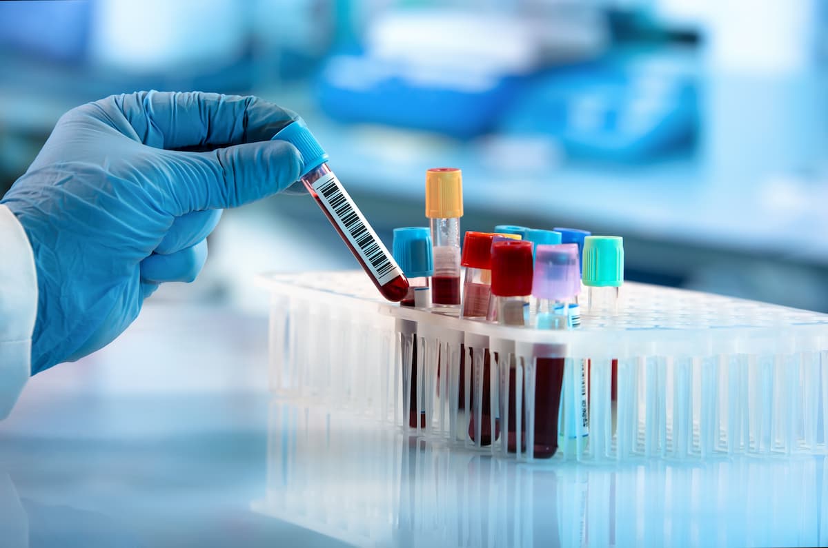 Technician holding blood tube test in the research laboratory / doctor hand taking a blood sample tube from a rack with machines of analysis in the lab background