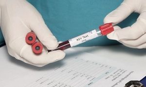 STI Prevention Key for Patients in PrEP Provision Programs