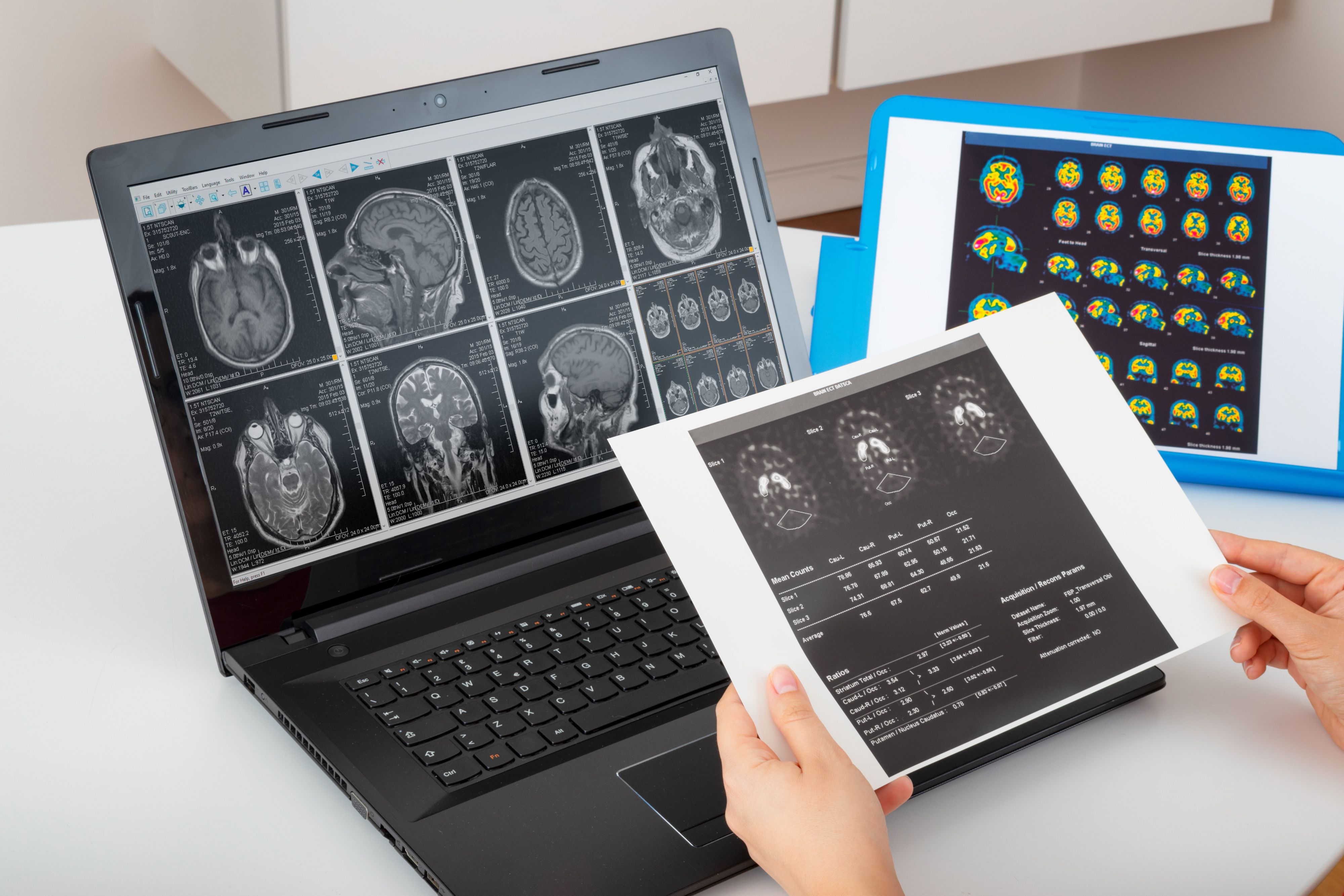 Open Lab Clinical Open-Label Trial Extension Supports Continued Long-Term Treatment With ...