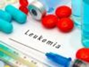 Case Study: CAR T Therapy Has Early Success as Acute Myeloid Leukemia Treatment