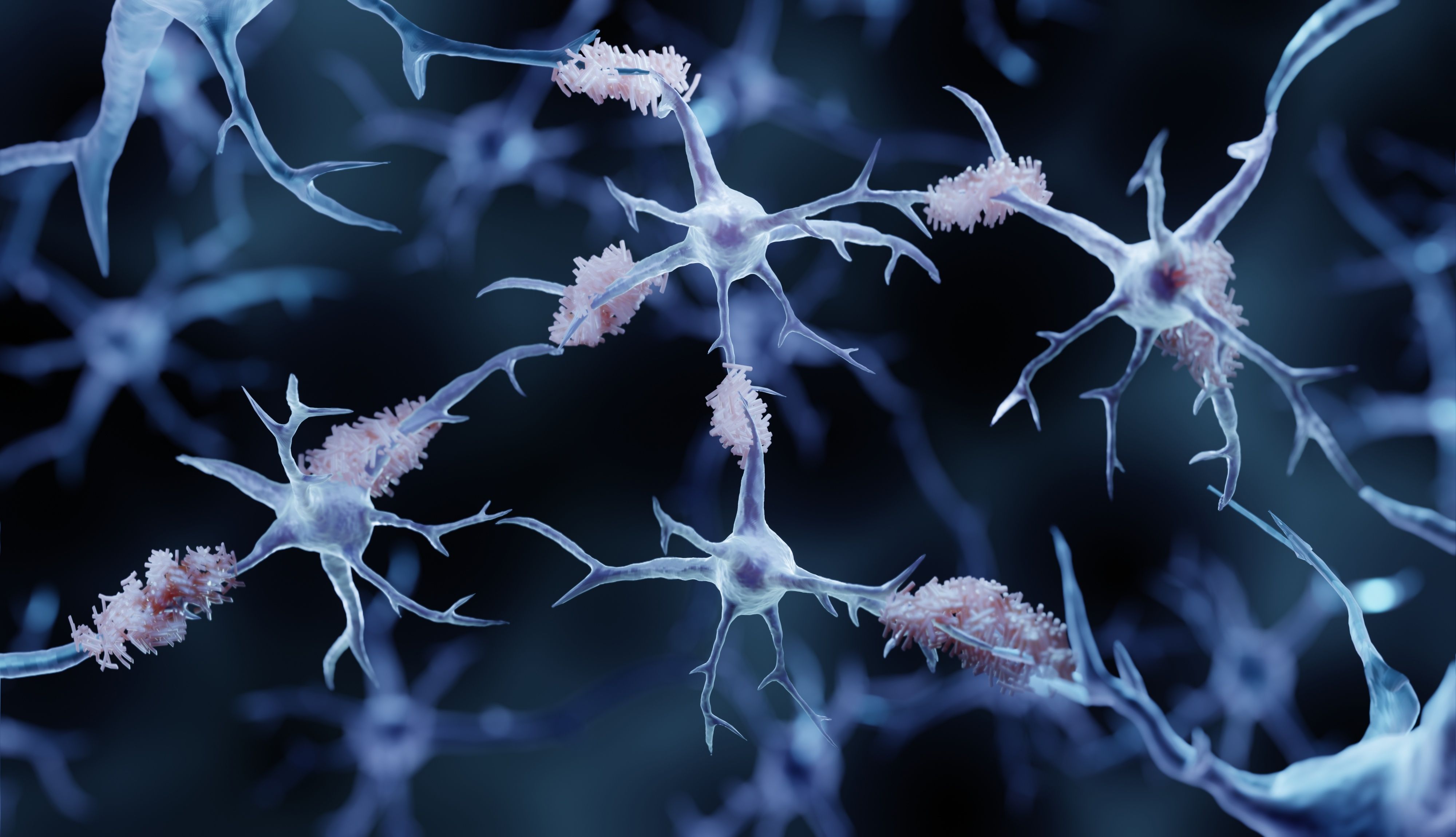 alzheimer, AAIC conference, GLP-1s