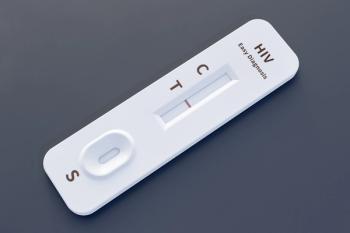 HIV test strip | Image Credit: © Mulin - stock.adobe.com