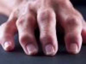 Patients Seek Quick Relief in Rheumatoid Arthritis