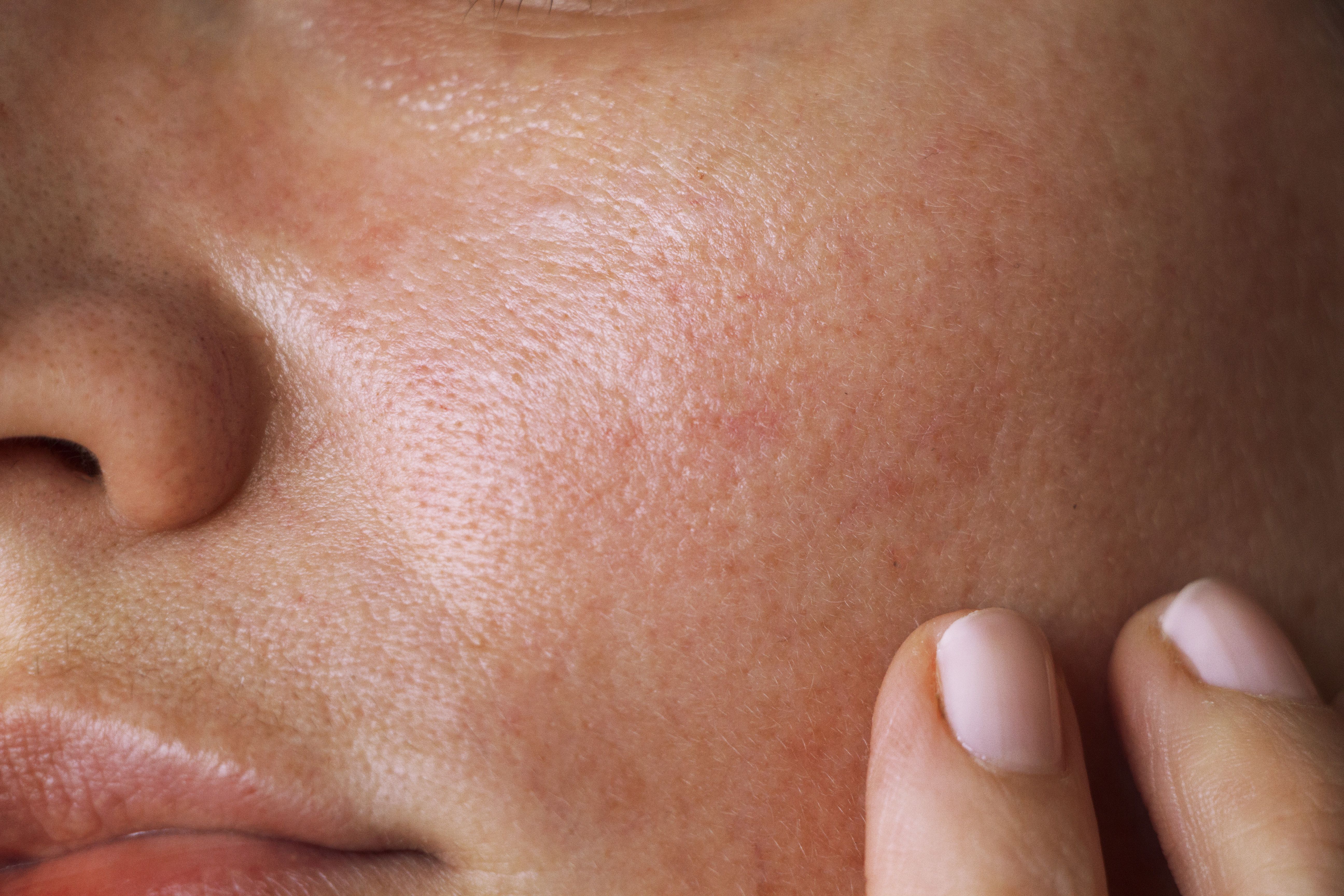 pores on the skin of the face. Cleansing the face skin - Image credit: Angelina | stock.adobe.com