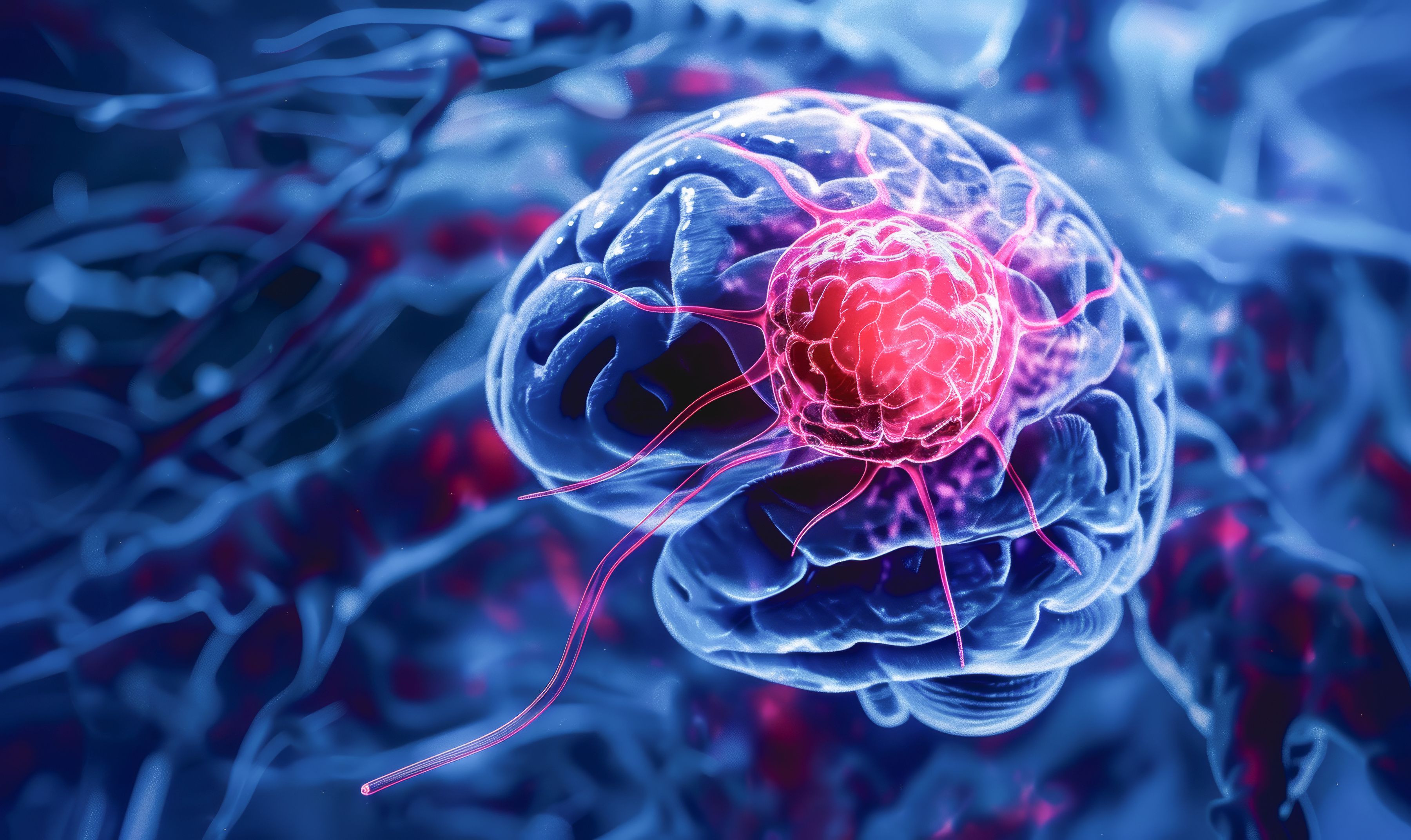 3D rendering of brain with a tumor | Image Credit: © iDoPixBox - stock.adobe.com
