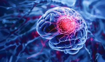 3D rendering of brain with a tumor | Image Credit: © iDoPixBox - stock.adobe.com