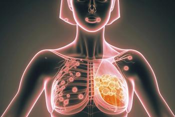 Schematic representation of metastatic breast cancer, breast cancer, AI generated | Image Credit: Paul Hart/imageBROKER | stock.adobe.com