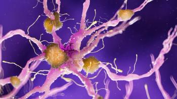 3d rendered medically accurate illustration of amyloid plaques on a alzheimer nerve cell | Image Credit: Sebastian Kaulitzki - stock.adobe.com