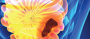 Patients with Advanced Cancer: Update on Pain Management