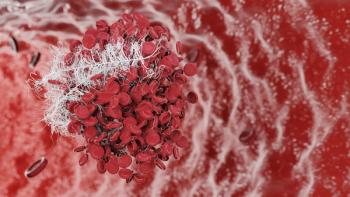 Aggregation blood cells. blood clot, Thrombus, embolus, Coagulated red and white blood cells. Thrombus blocking and red blood cells stream. 3d render.