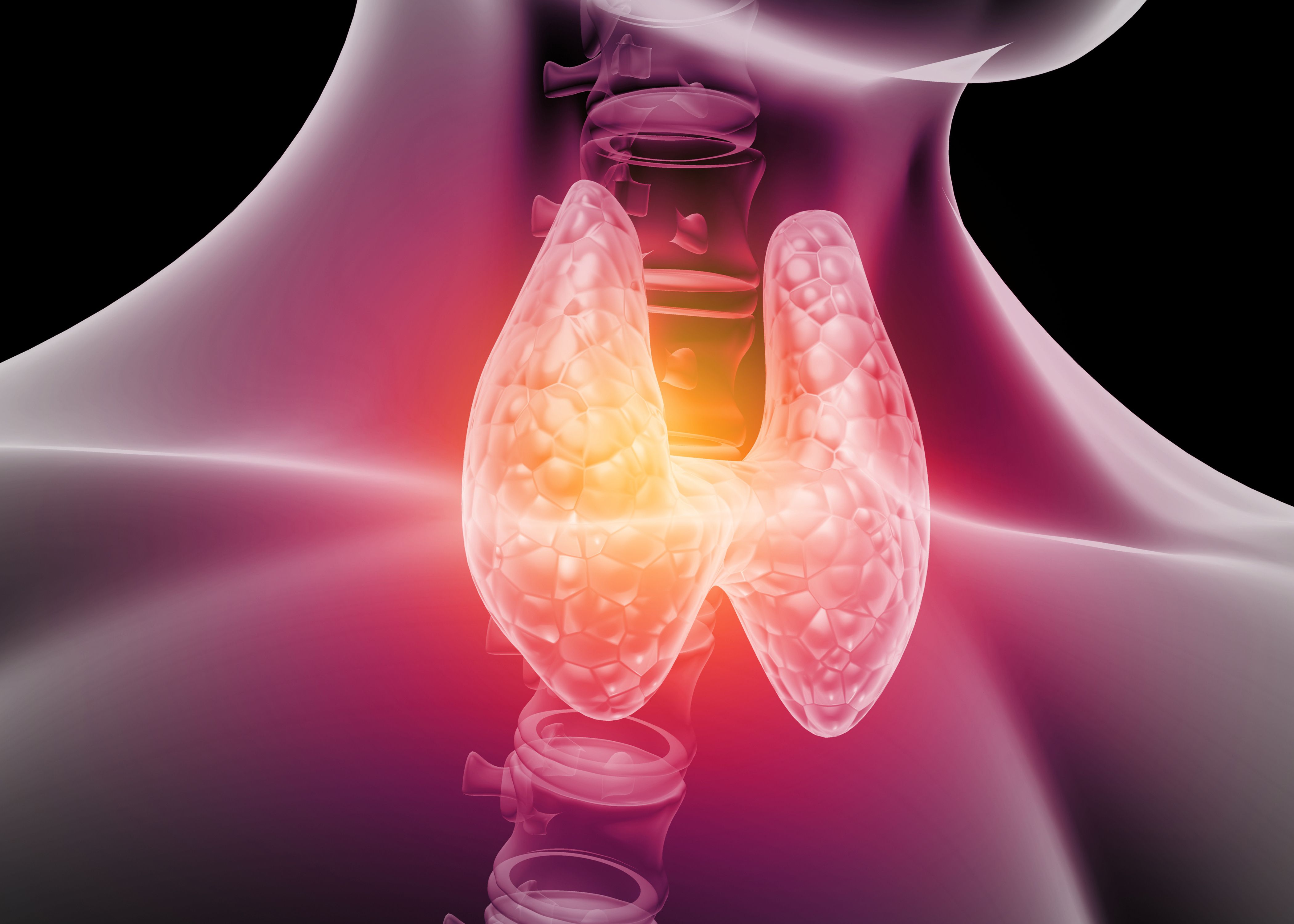X-ray image of thyroid -- Image credit: Rasi | stock.adobe.com