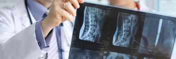 Close-up of doctors hands holding x-ray vertebra in different projections. Physician colleagues discussing diagnosis of patient. Medicine and healthcare concept | Image Credit: H_Ko - stock.adobe.com
