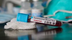 CVS Pharmacy Offering Three OTC COVID-19 Tests