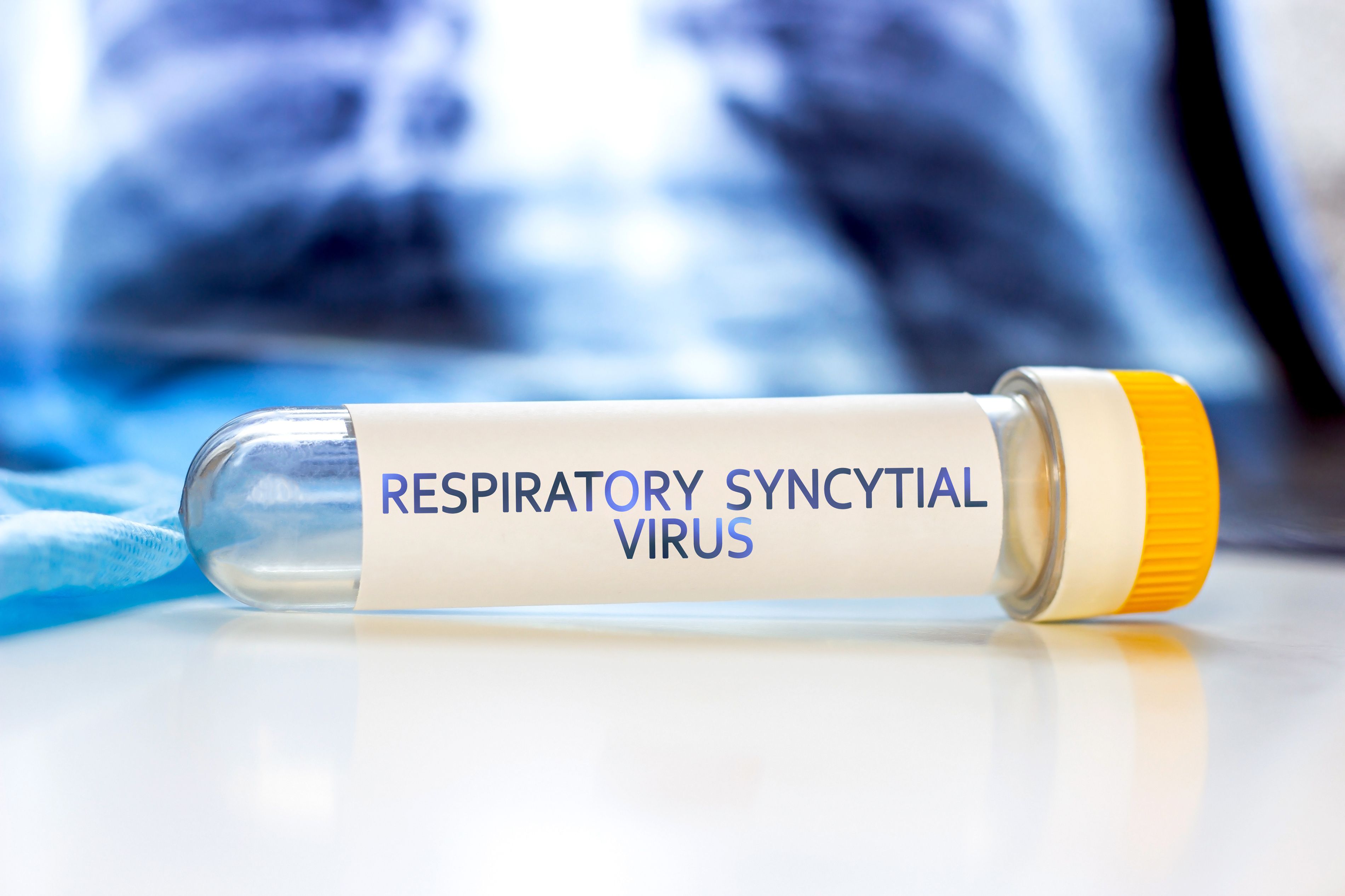Respiratory Syncytial Virus with lung ct scan aside on light blue background. RSV disease concept. | Image Credit: KatMoy - stock.adobe.com