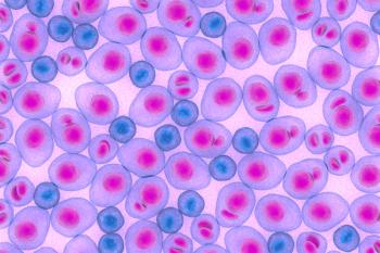 Multiple Myeloma multiplex leukemia cancer 3d color render illustration | Image Credit: © LASZLO - stock.adobe.com 