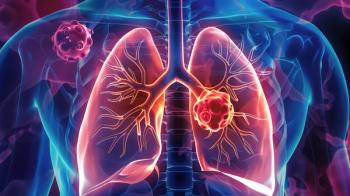Lung Cancer: Pulmonary Malignant Tumor Screening, Diagnosis and Treatment | Thoracic Oncology Medical Research & Clinical Healthcare Visual Resources | Image Credit: 程 加星 | stock.adobe.com