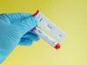 Hepatitis C: The Pan-Virals Are on the Way