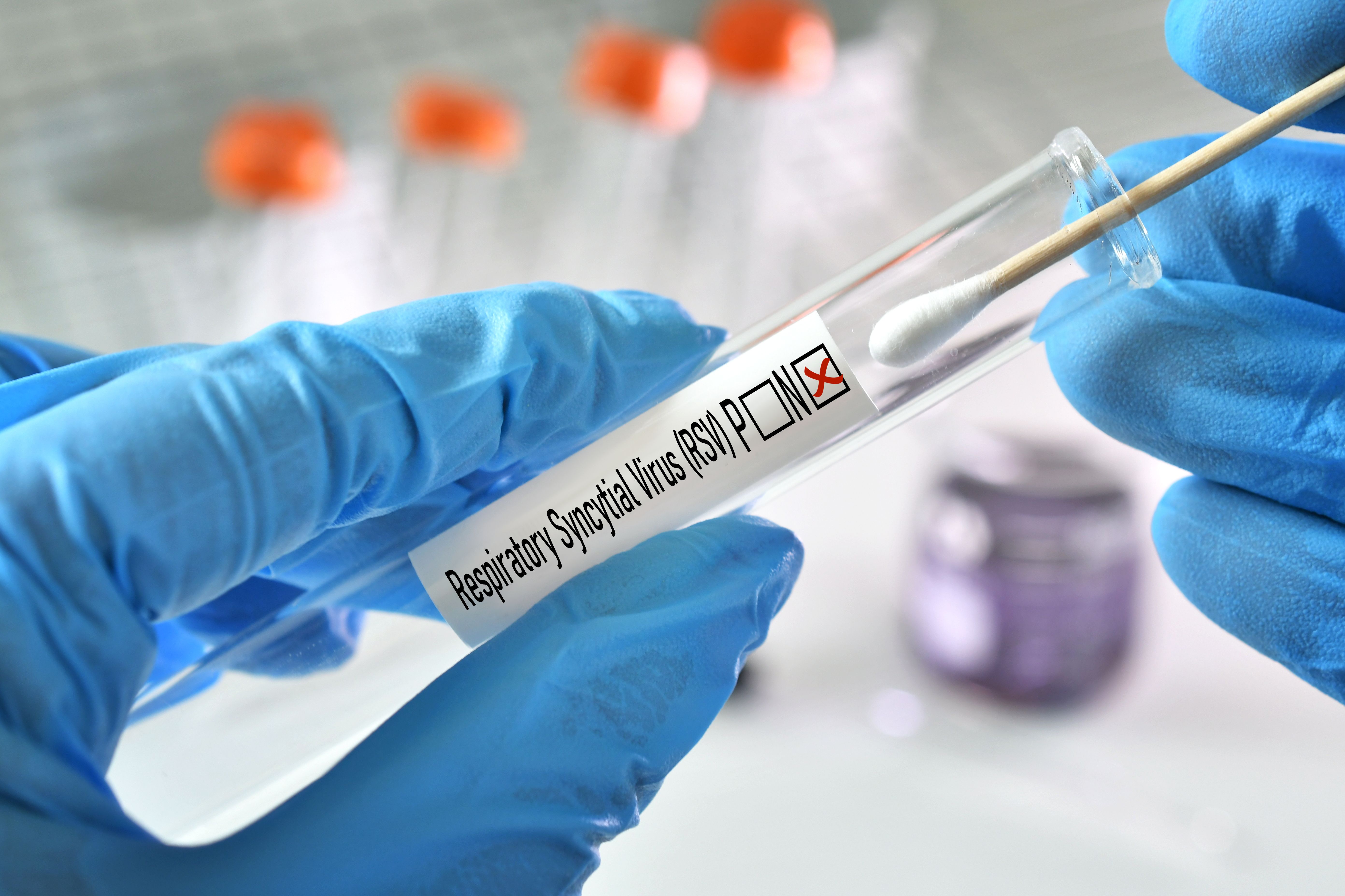 Medical personnel holding negative test of RSV Respiratory Syncytial Virus -Image credit: MargJohnsonVA | stock.adobe.com