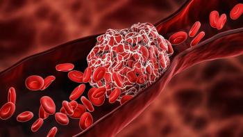 Blood Clot or thrombus blocking the red blood cells stream within an artery or a vein 3D rendering illustration.
