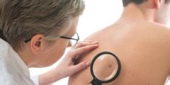 EP. 3 Diagnosis and Assessment of Melanoma