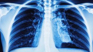 HER2 and HER3 ADCs in Focus: Clinical Pearls for Managing Emerging Toxicities