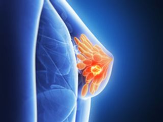 New Drug Could Change Treatment Landscape for ER-Positive, HER2-Negative Breast Cancer