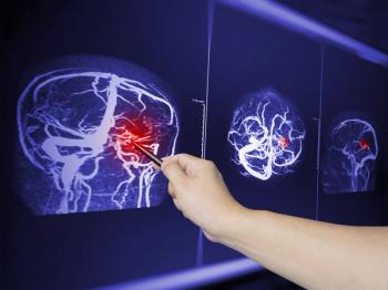 Close up Hand doctor point MRA brian scan image of a recent traumatic brain injury patient showing brain contusion and hemorrhage.Medical image concept. | Image Credit: Richman Photo | stock.adobe.com 