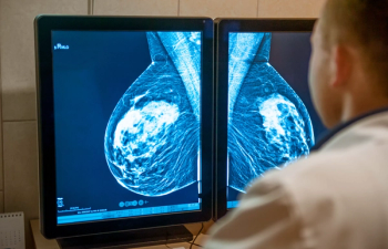 Expert presents Updates in Early-Stage Breast Cancer from the HOPA 2023 Annual Conference. Credit: okrasiuk - stock.adobe.com.