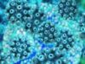Will Resistance Associated Variants Affect the HCV Treatment Paradigm?
