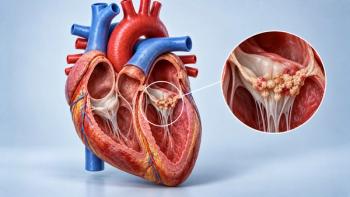 medical cross section of human heart with zoomed detail of bacterial endocarditis on heart valve - Image credit: Aleya | stock.adobe.com