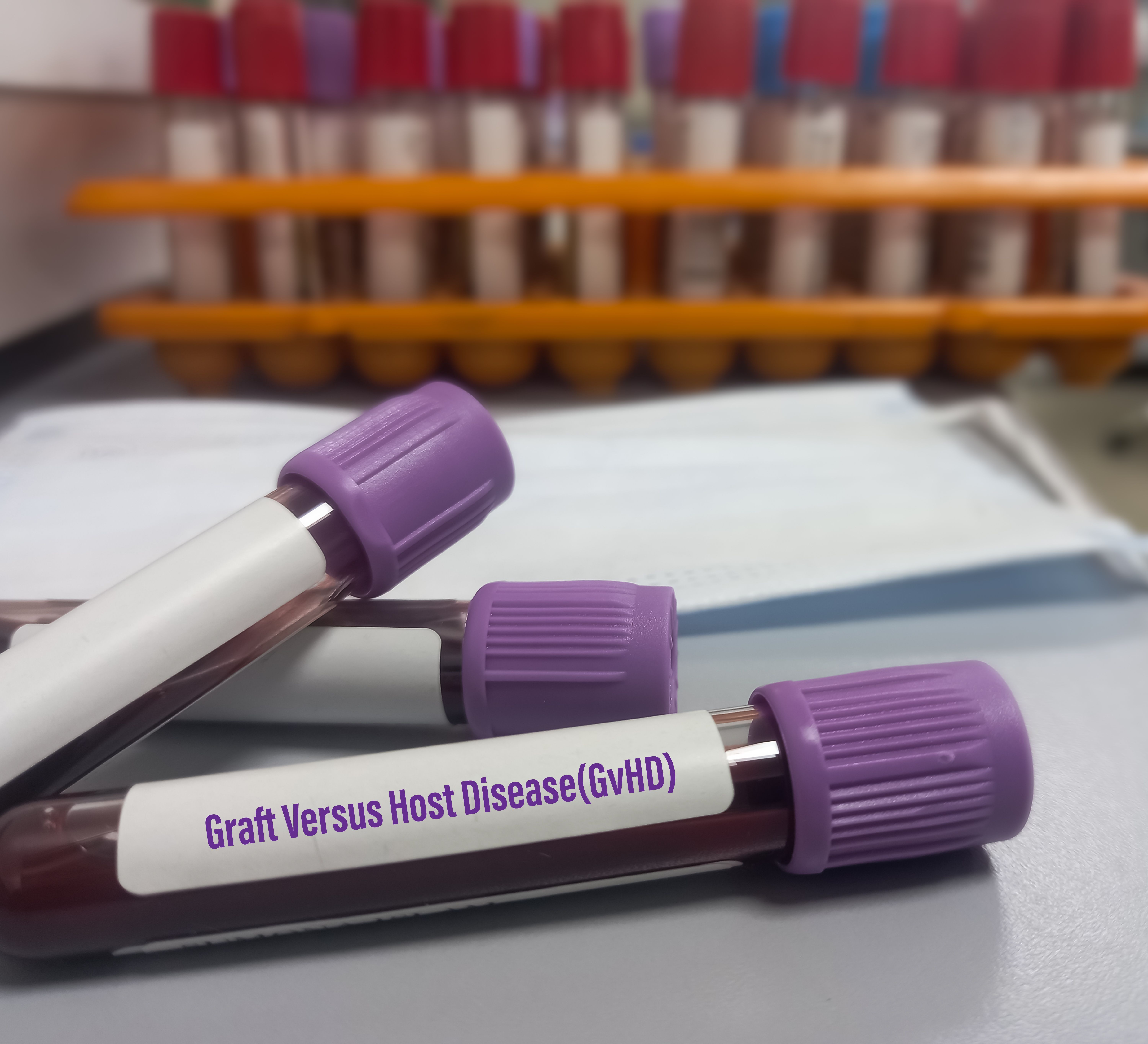Cellular Immune Reconstitution Varies Across GVHD Prophylaxis Strategies in HSCT