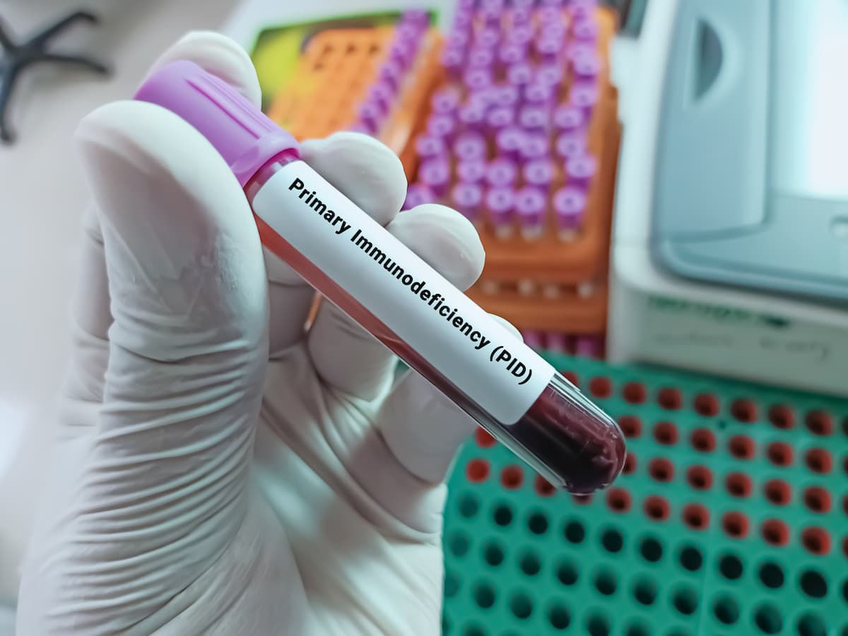 Doctor hold Blood sample for Primary Immunodeficiency (PID) test. Medical testing concept with laboratory background.