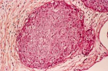 Scan of breast cancer -- Image credit: Science RF | stock.adobe.com