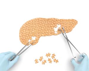 Pancreas puzzle concept: hands of surgeon with surgical instruments (tools) perform pancreas surgery as a result of acute or chronic pancreatitis, pancreatic diabetes, pancreatic cancer | Image Credit: sakramir | stock.adobe.com