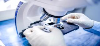 Researchers Say CAEL-101 is an Effective Amyloid Light Chain Amyloidosis Treatment