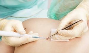 Pharmacists Can Play an Important Role in Treating Skin Cancer