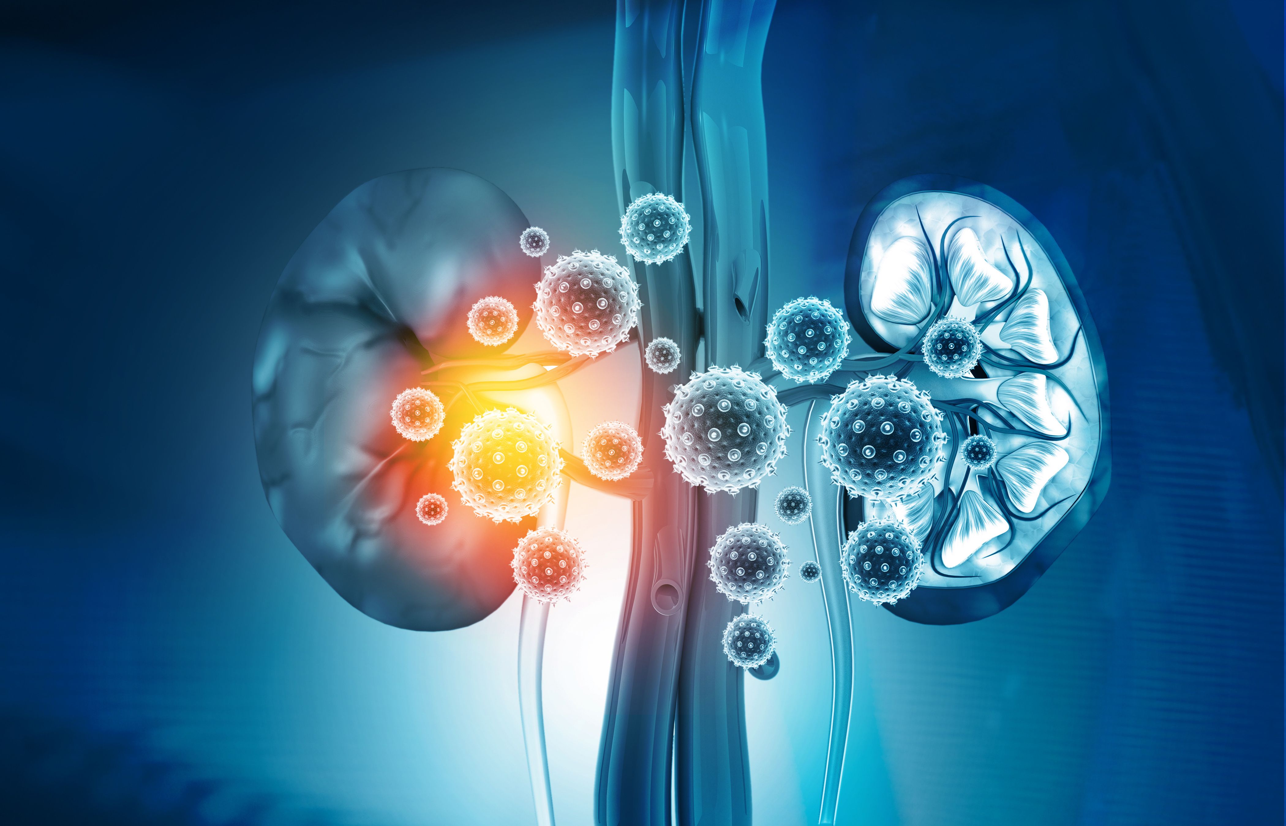 Diabetes, Diabetic Kidney Disease, Chronic Kidney Disease | Image Credit: Rasi - stock.adobe.com