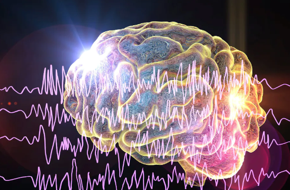 Perceived Cognitive Deficits Associated With Post–COVID-19 Condition