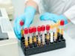 Men Favor Prostate Cancer Test Despite Task Force Recommendation